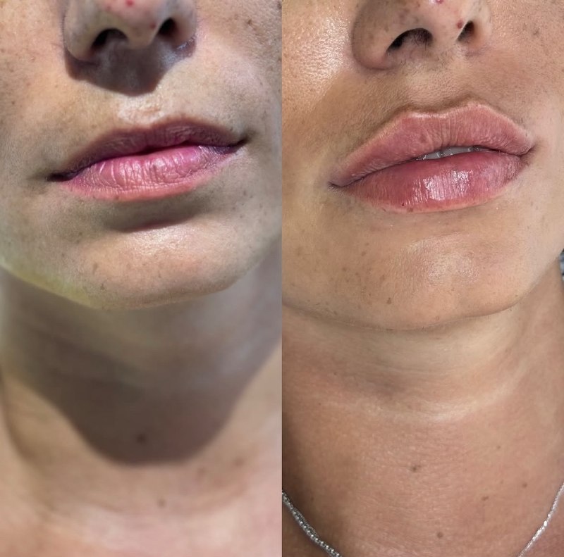Before and after — case 4
