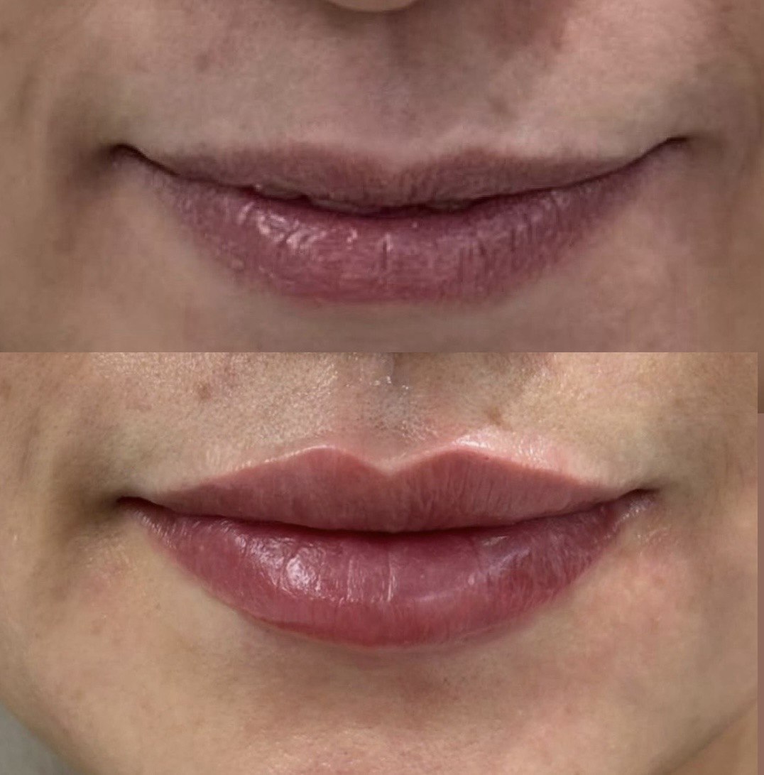 Before and after — case 5